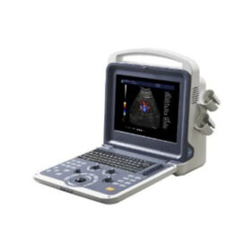 Portable Color Doppler Ultrasound Scanner