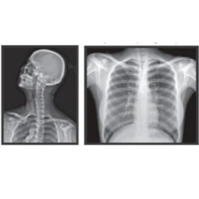 X-ray Film  11”x14”