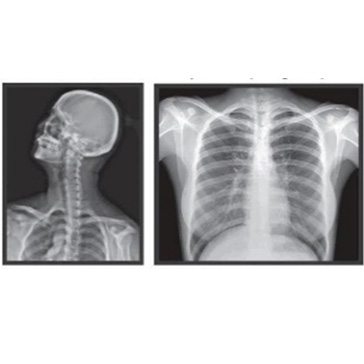 X-ray Film 11”x14”