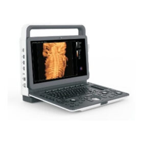 Portable Color Doppler Ultrasonic Diagnostic System