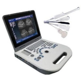 B/W Ultrasound scanner